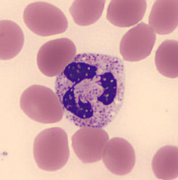 File:Hem1SegmNeutrophile4.jpg