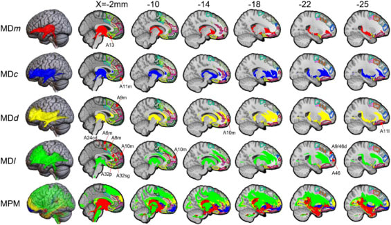 Medio-Dorsal Thalamic Linkages in Cortex