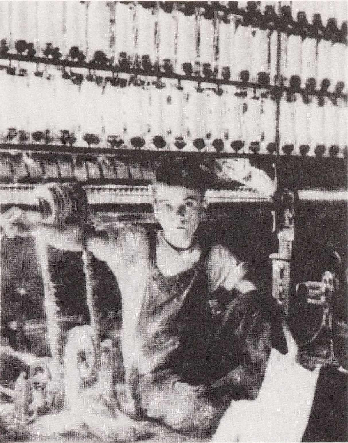 Demonstration of how a boy lost his arm