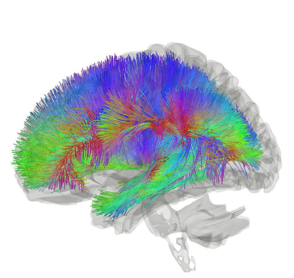 Thalamo-Cortico Whitematter from Wikipedia