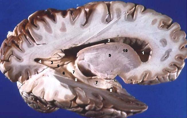 Brain white matter cross section