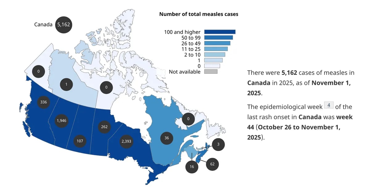 measles-canada